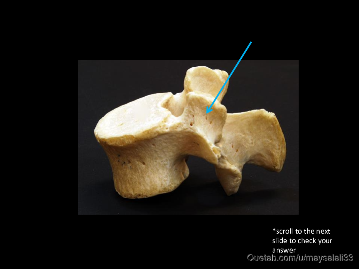 Bone Practice Exam