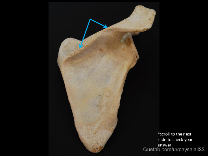 Bone Practice Exam