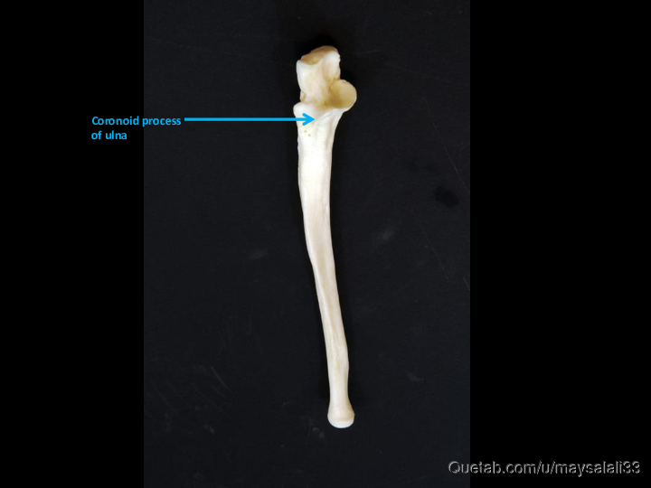 Bone Practice Exam