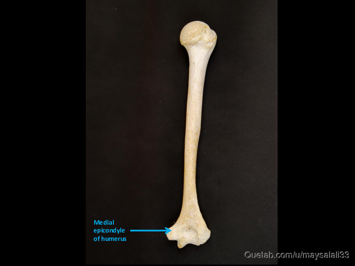 Bone Practice Exam