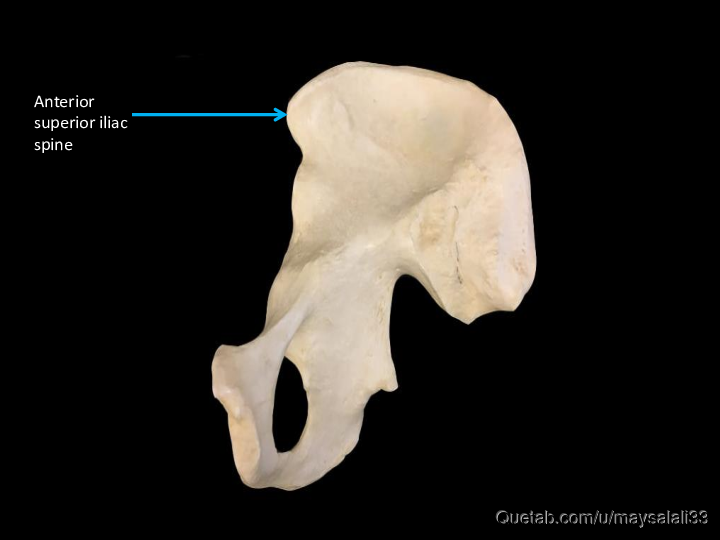 Bone Practice Exam