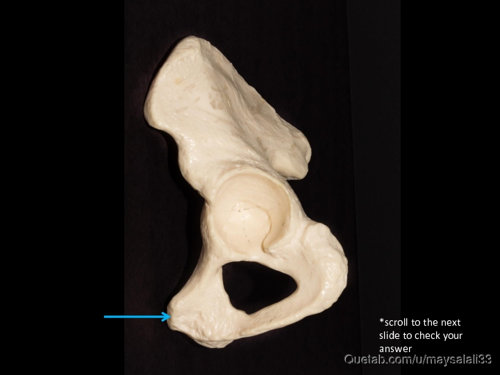 Bone Practice Exam