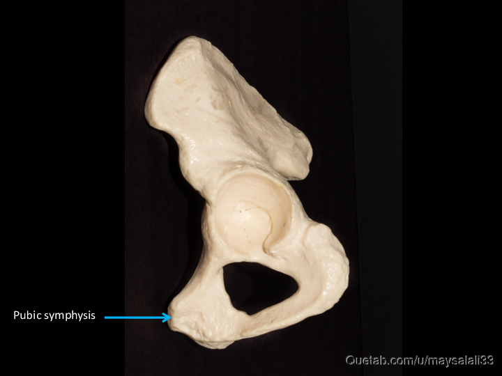 Bone Practice Exam