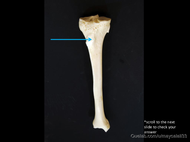 Bone Practice Exam